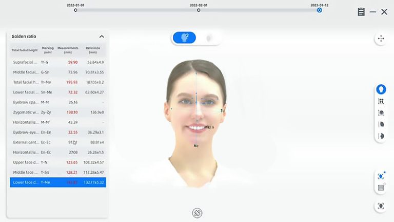 MetiSmile 3D Face Scanner