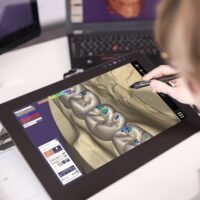 Exocad Chairside CAD Mill Bundle